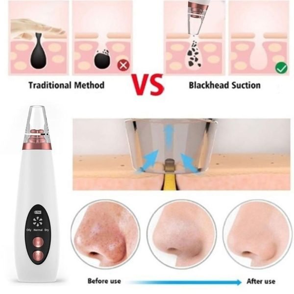 6-In-1 Blackhead Remover Cleaner Vacuum Tool (Rechargeable)